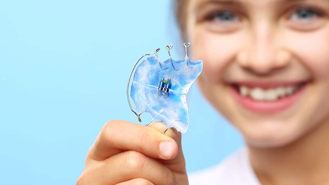 Interceptive Orthodontics